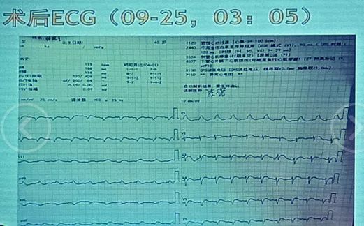 村姑啄木鸟满天星