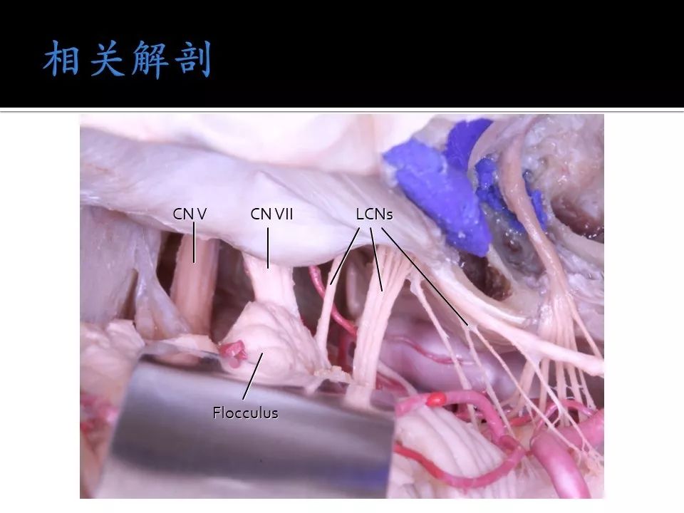 中文字幕无线观看中文字幕